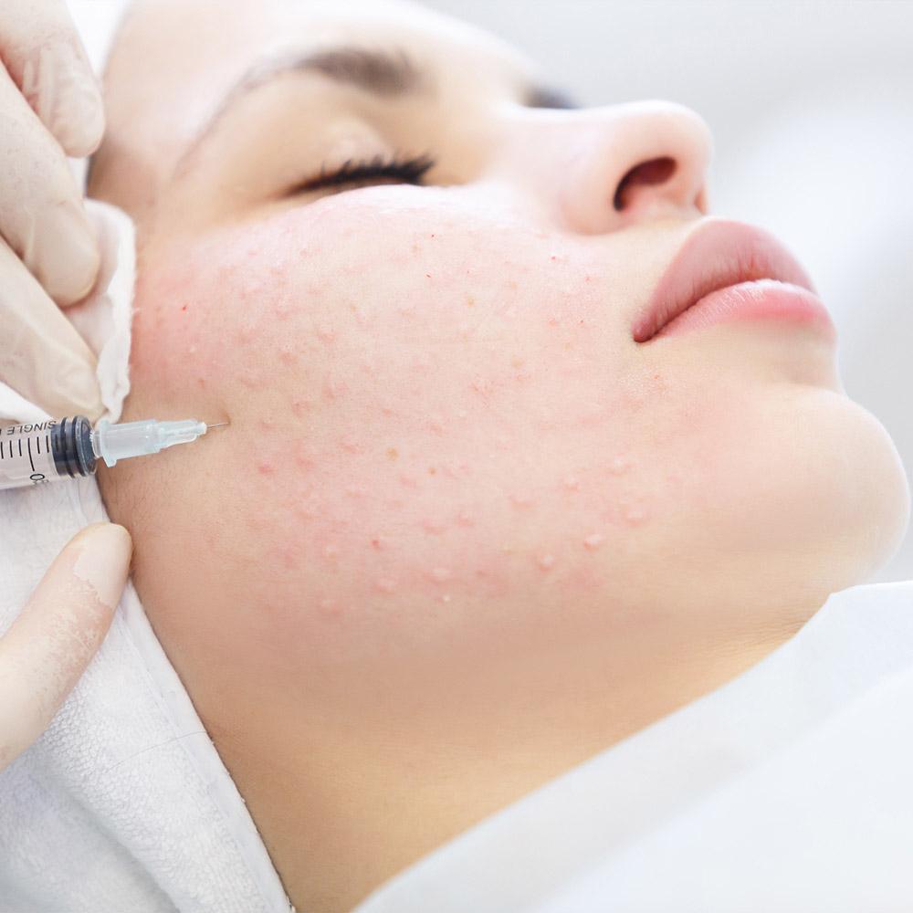 Revitalización facial y corporal